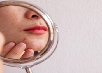 Conheça 5 sinais de que sua pele está estressada