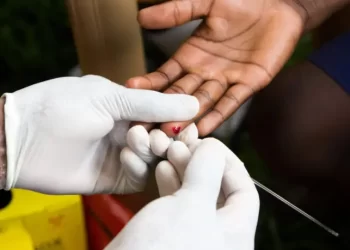 Farmácias poderão realizar testes rápidos de HIV e sífilis