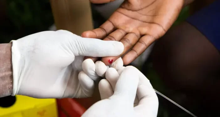 Farmácias poderão realizar testes rápidos de HIV e sífilis