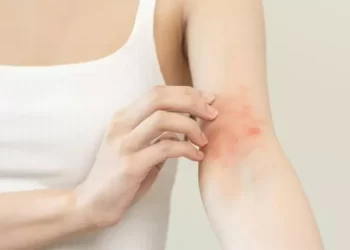 Veja 6 doenças de pele agravadas no inverno e como evitar crises