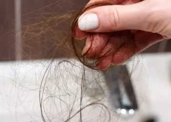Mitos x Verdades sobre a queda de cabelo