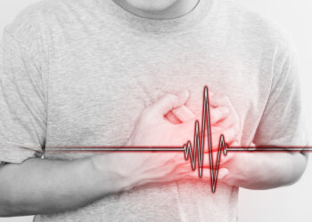 O que significa ter um infarto? Conheça sintomas e tratamento