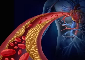 Colesterol ruim: o que é e como saber se está alto