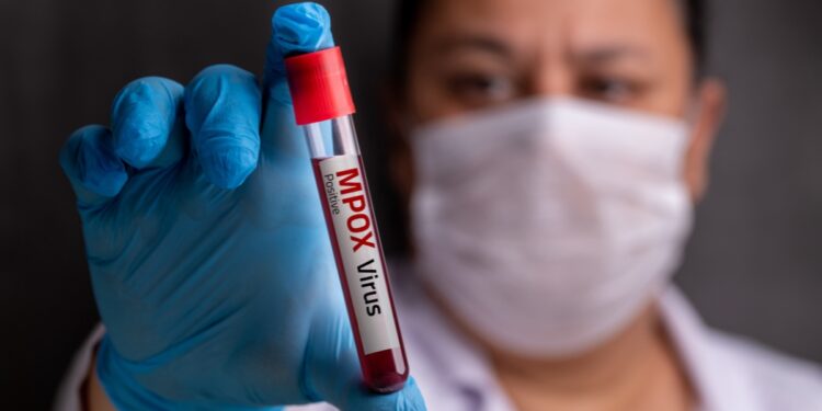 OMS aprova primeiro teste de mpox para uso emergencial