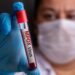 OMS aprova primeiro teste de mpox para uso emergencial