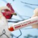 Gripe aviária: entenda a doença que afeta aves e pode atingir humanos
