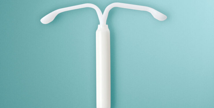 DIU hormonal é incorporado ao SUS como tratamento para endometriose