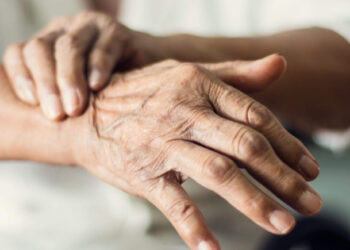 Teste com sebo da pele pode diagnosticar Parkinson até sete anos antes dos sintomas