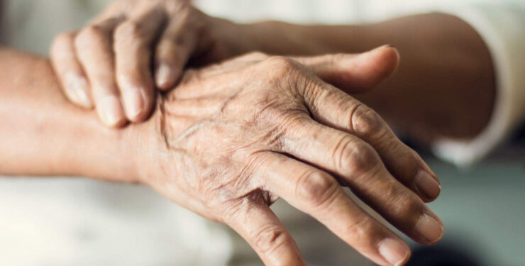 Teste com sebo da pele pode diagnosticar Parkinson até sete anos antes dos sintomas