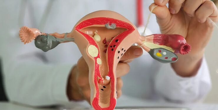 Mulheres não precisam mais da autorização do marido para fazer laqueadura