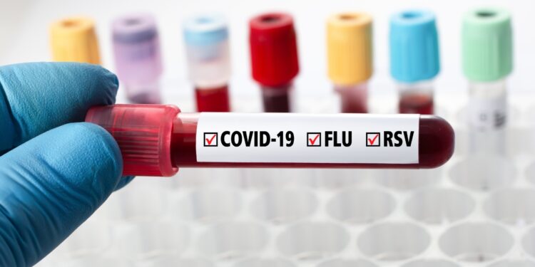 Covid-19: Brasil registra primeiros casos de nova variante