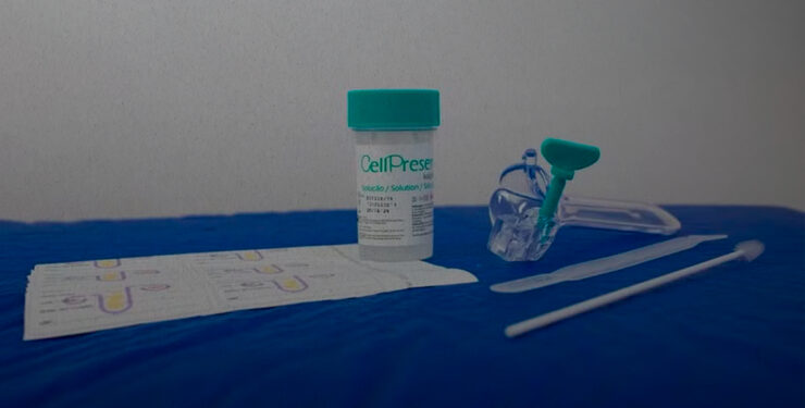 Novo exame gratuito do SUS detecta HPV com mais precisão