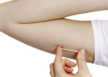 Planos de saúde terão de oferecer implante contraceptivo hormonal