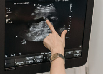 Anvisa aprova novo tratamento para câncer de ovário resistente à quimioterapia