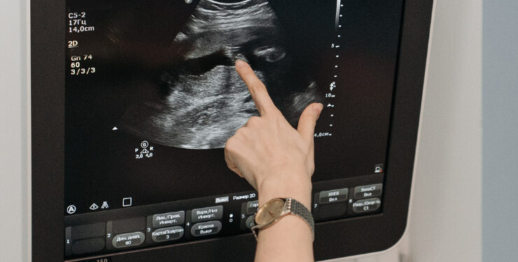 Anvisa aprova novo tratamento para câncer de ovário resistente à quimioterapia