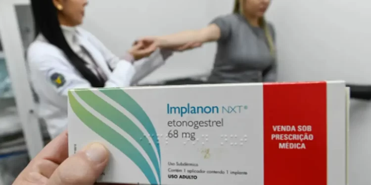 Implante contraceptivo deve ser ofertado por planos a partir desta segunda-feira (1°)