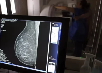 Falta de acesso a mamógrafos limita prevenção do câncer de mama