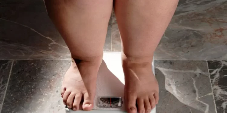Avanço da obesidade no país acende alerta para prevenção