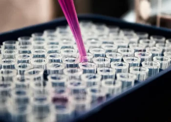 Estudo mostra que inflamação no cérebro pode ser chave do Alzheimer