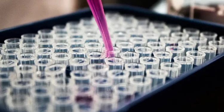 Estudo mostra que inflamação no cérebro pode ser chave do Alzheimer