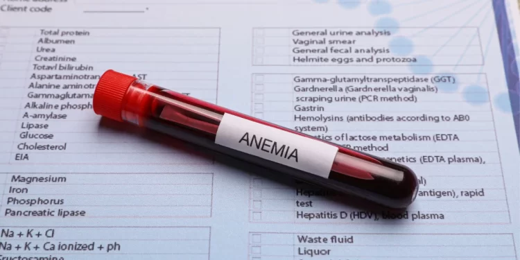 Entenda a anemia ferropriva e o papel do ferro