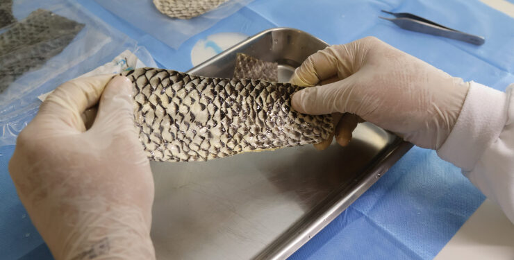 Curativo produzido com pele de tilápia entra na fase final para chegar ao mercado