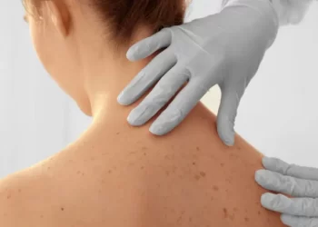 Dezembro Laranja reforça os cuidados contra o câncer de pele