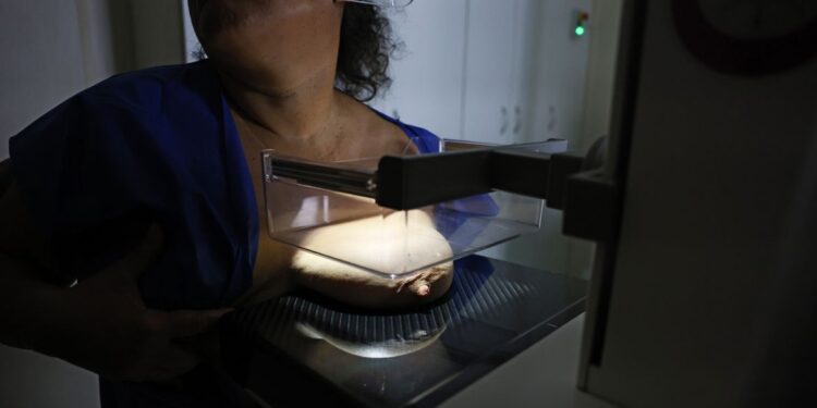 92% das brasileiras entre 50 e 69 anos fizeram mamografia, aponta Vigitel