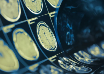 Nova molécula reduz em 26% segundo AVC, diz estudo da Bayer