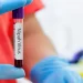 Vírus Nipah: há risco de surto no Carnaval?