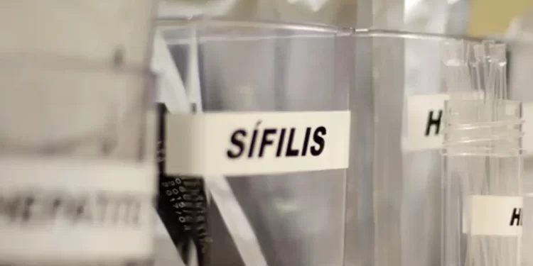 SUS passa a adotar antibiótico para prevenir sífilis e clamídia