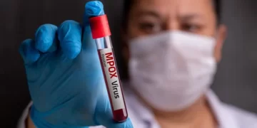 Mpox mata? Pega pelo ar? Beijo transmite? veja as principais buscas do Google sobre a doença