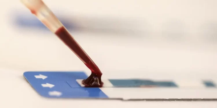 Estudo inédito da Fiocruz pode ampliar prevenção de HIV entre jovens