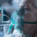 Gripe avança antes do esperado e dobra casos graves no Brasil em 2026