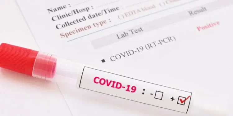 Covid: virologistas fazem alerta sobre nova variante BA.3.2