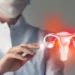 4 em cada 10 brasileiras desconhecem a endometriose, revela pesquisa