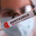 Surto de Hantavírus no navio não representa risco para o Brasil