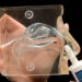 Spray nasal com nanopartículas pode ajudar no início do AVC
