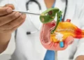 Novo medicamento dobra sobrevida de pacientes com câncer de pâncreas