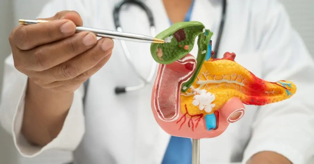 Novo medicamento dobra sobrevida de pacientes com câncer de pâncreas