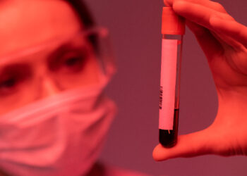 Maioria dos pacientes que descobrem HIV em estágio avançado é heterossexual, aponta estudo