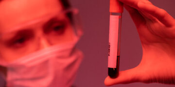 Maioria dos pacientes que descobrem HIV em estágio avançado é heterossexual, aponta estudo