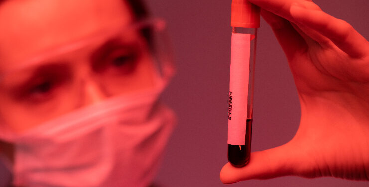 Maioria dos pacientes que descobrem HIV em estágio avançado é heterossexual, aponta estudo