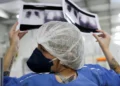 Diagnóstico tardio dá poucas chances de cura para o câncer de pulmão