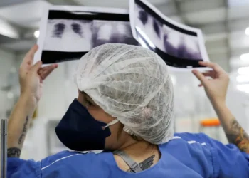 Diagnóstico tardio dá poucas chances de cura para o câncer de pulmão
