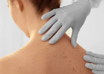 Moderna e Merck anunciam eficácia de vacina contra câncer de pele