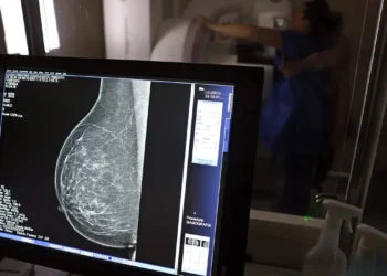 Médicos lançam guia para evitar recusa de mamografia digital