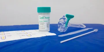 SUS detecta quase 10 mil testes positivos para HPV de alto risco
