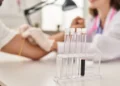 Exame de sangue para Alzheimer chega a hospital brasileiro