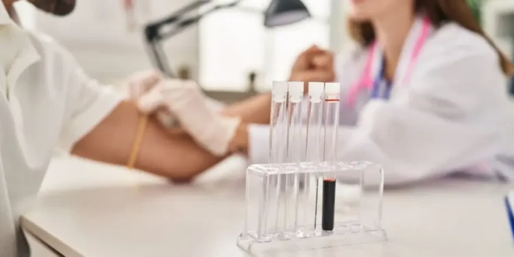 Exame de sangue para Alzheimer chega a hospital brasileiro